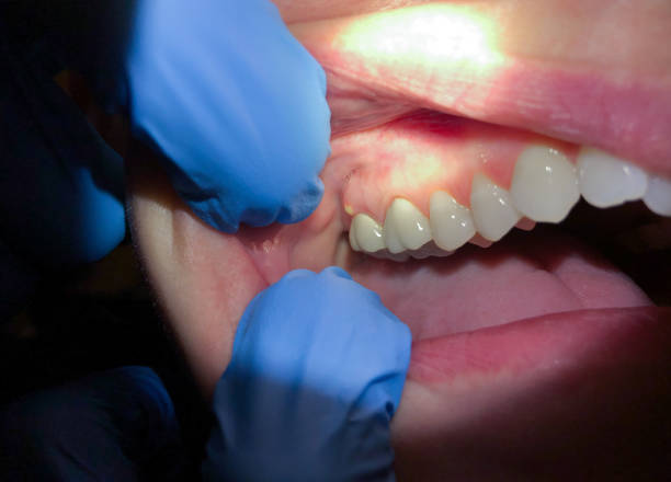 Best Same-Day Emergency Dental Services in Gardendale, TX