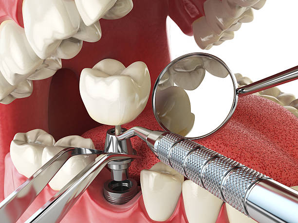Best Emergency Denture Repair in Gardendale, TX